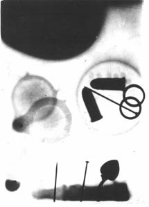 The first X-ray taken at Davidson College by Eben Hardin, Pender Porter, and Osmond L. Barringer.