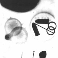 The first X-ray taken at Davidson College by Eben Hardin, Pender Porter, and Osmond L. Barringer.